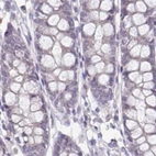 Immunohistochemical staining of human colon using Anti-ACTRT2 antibody HPA006480.