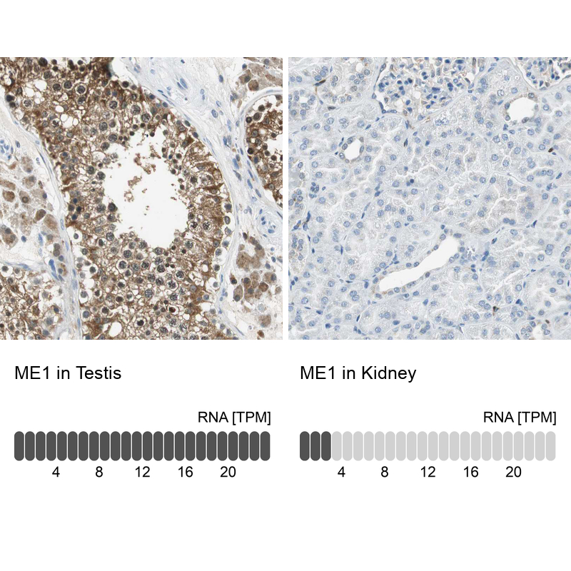 Anti-ME1 Antibody