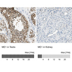 Anti-ME1 Antibody
