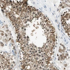 Immunohistochemical staining of human testis shows moderate cytoplasmic positivity in cells in seminiferous ducts.