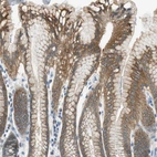 Immunohistochemical staining of human stomach shows moderate cytoplasmic positivity in glandular cells.