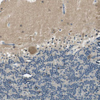 Immunohistochemical staining of human cerebellum shows weak cytoplasmic positivity in Purkinje cells.