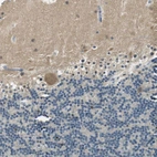Immunohistochemical staining of human cerebellum shows weak cytoplasmic positivity in Purkinje cells.