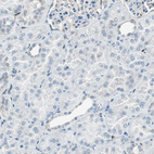 Immunohistochemical staining of human kidney shows no positivity in cells in tubules as expected.