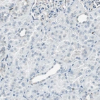 Immunohistochemical staining of human kidney shows no positivity in cells in tubules as expected.