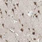 Anti-PFDN1 Antibody