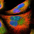 Immunofluorescent staining of human cell line A-431 shows localization to nucleoli, plasma membrane & cytosol.