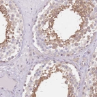 Anti-TBC1D9 Antibody