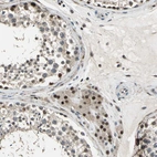 Immunohistochemical staining of human testis shows strong nuclear positivity in Leydig cells.