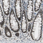 Immunohistochemical staining of human rectum shows strong nuclear positivity in glandular cells.
