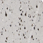 Immunohistochemical staining of human cerebral cortex shows strong nuclear positivity in neurons.