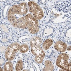 Anti-PCK1 Antibody