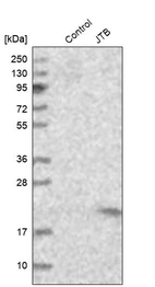 Western blot analysis in control (vector only transfected HEK293T lysate) and JTB over-expression lysate (Co-expressed with a C-terminal myc-DDK tag (~3.1 kDa) in mammalian HEK293T cells, LY402003).