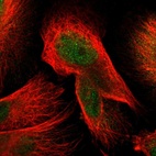 Immunofluorescent staining of human cell line U-251 MG shows localization to nucleoplasm & cytosol.