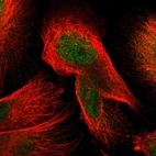 Immunofluorescent staining of human cell line U-251 MG shows localization to nucleoplasm & cytosol.