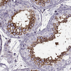 Anti-SLC2A3 Antibody