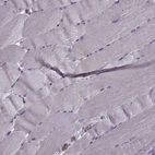 Immunohistochemical staining of human skeletal muscle shows no membranous positivity in myocytes as expected.
