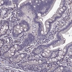Immunohistochemical staining of human small intestine shows no membranous positivity in glandular cells as expected.