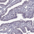 Immunohistochemical staining of human fallopian tube shows no membranous positivity in glandular cells as expected.