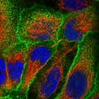 Immunofluorescent staining of human cell line CACO-2 shows localization to plasma membrane.