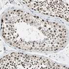Immunohistochemical staining of human testis shows strong nuclear positivity in cells in seminiferous ducts.