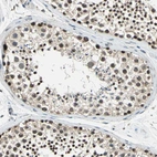 Immunohistochemical staining of human testis shows strong nuclear positivity in cells in seminiferous ducts.
