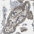 Immunohistochemical staining of human placenta shows moderate nuclear positivity in trophoblastic cells.