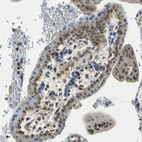 Immunohistochemical staining of human placenta shows moderate nuclear positivity in trophoblastic cells.