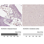 Anti-ACACB Antibody