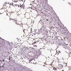 Immunohistochemical staining of human adipose tissue shows moderate cytoplasmic positivity in adipocytes.