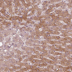 Immunohistochemical staining of human liver shows moderate cytoplasmic positivity in hepatocytes.