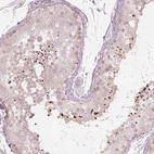Immunohistochemical staining of human testis shows strong positivity in spermatids.
