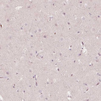 Immunohistochemical staining of human cerebral cortex shows no positivity in neurons as expected.