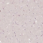 Immunohistochemical staining of human cerebral cortex shows no positivity in neurons as expected.