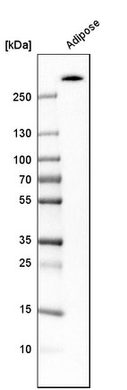 Western blot analysis in human adipose tissue tissue.