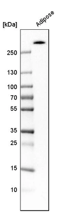 Western blot analysis in human adipose tissue tissue.