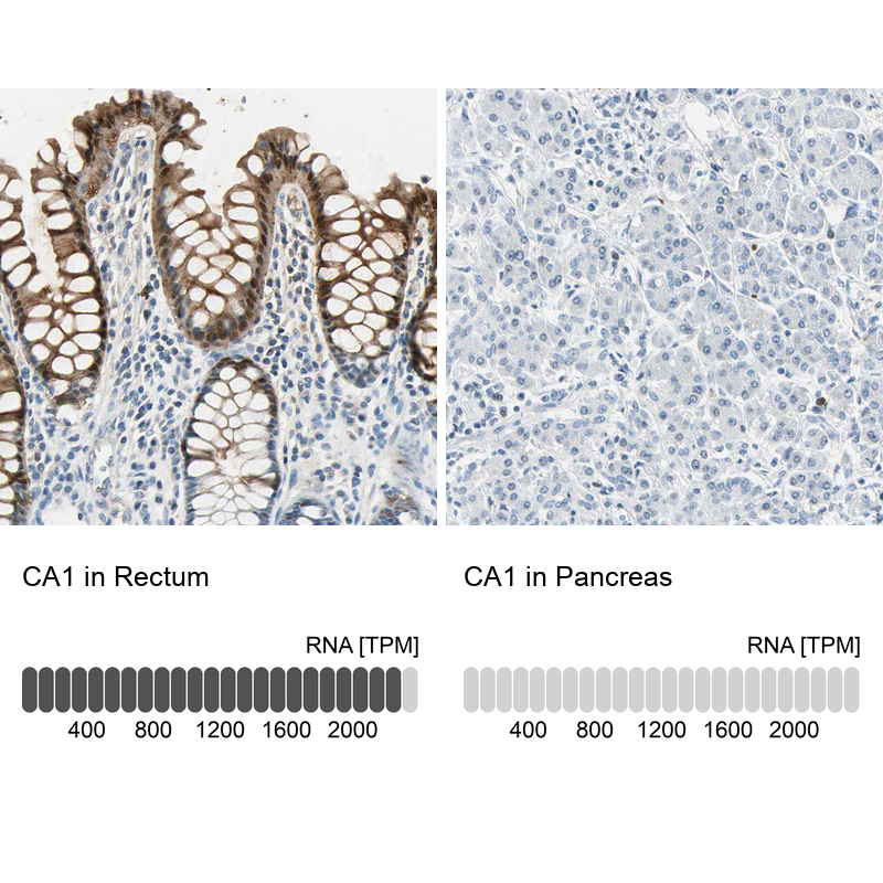 Anti-CA1 Antibody