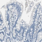 Immunohistochemical staining of human duodenum shows no positivity in glandular cells as expected.