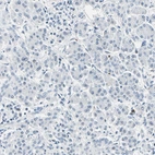 Immunohistochemical staining of human pancreas shows no positivity in exocrine glandular cells as expected.