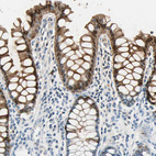 Immunohistochemical staining of human rectum shows strong cytoplasmic and nuclear positivity in glandular cells.