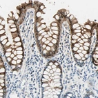 Immunohistochemical staining of human rectum shows strong cytoplasmic and nuclear positivity in glandular cells.