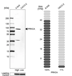 Western blot analysis in human cell lines A-549 and Caco-2 using Anti-PRKCA antibody. Corresponding PRKCA RNA-seq data are presented for the same cell lines. Loading control: Anti-GAPDH.