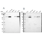 Western blot analysis using Anti-PRKCA antibody HPA006563 (A) shows similar pattern to independent antibody HPA006564 (B).