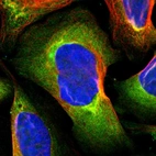 Immunofluorescent staining of human cell line U-2 OS shows localization to plasma membrane & cytosol.