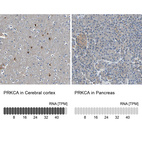 Anti-PRKCA Antibody