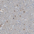 Immunohistochemical staining of human cerebral cortex shows high expression.