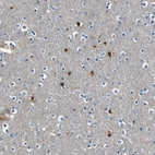 Immunohistochemical staining of human cerebral cortex shows high expression.
