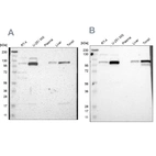 Western blot analysis using Anti-PRKCA antibody HPA006564 (A) shows similar pattern to independent antibody HPA006563 (B).