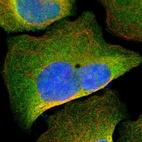 Immunofluorescent staining of human cell line U-2 OS shows localization to plasma membrane & cytosol.