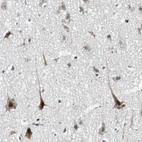 Immunohistochemical staining of human cerebral cortex shows moderate nuclear and cytoplasmic positivity in neurons.
